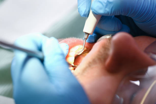 Best Emergency Dental Surgery in Wahpeton, ND