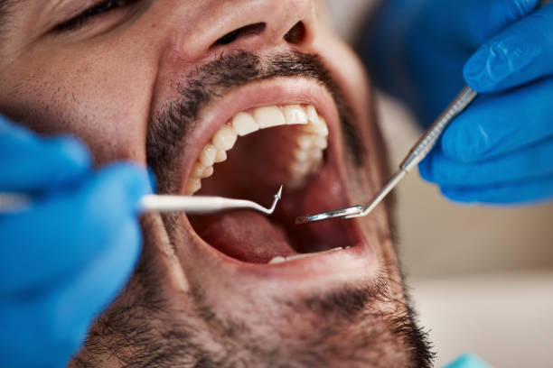 Best Pediatric Emergency Dentist in Wahpeton, ND